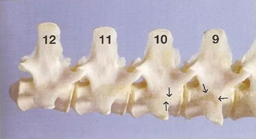 Envejecimiento de las vértebras (cocodrilos) - Vista oblicua de las vértebras de un cocodrilo - Indicadores morfológicos de la edad